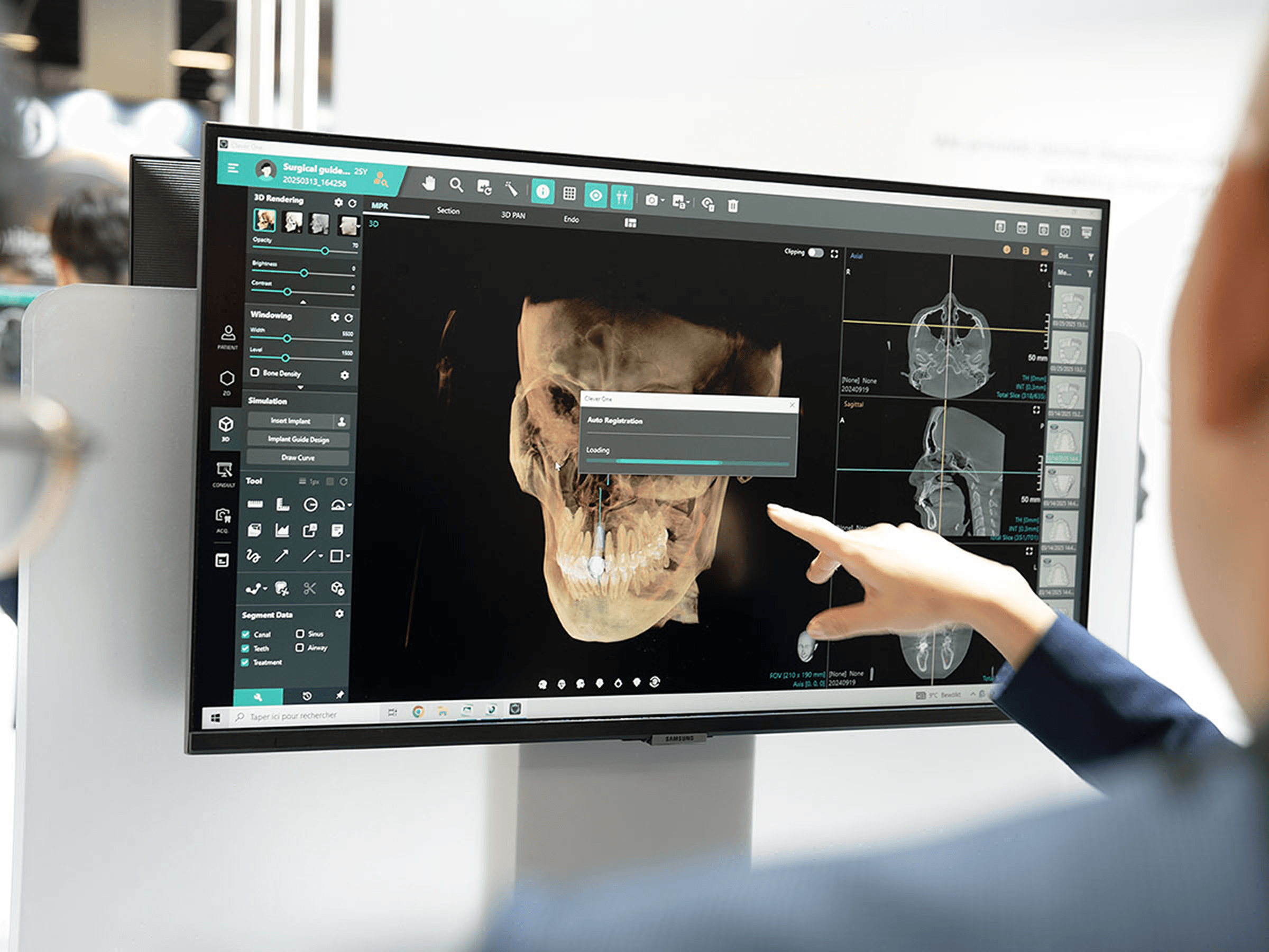 Imaging system running Eyes of AI analysis