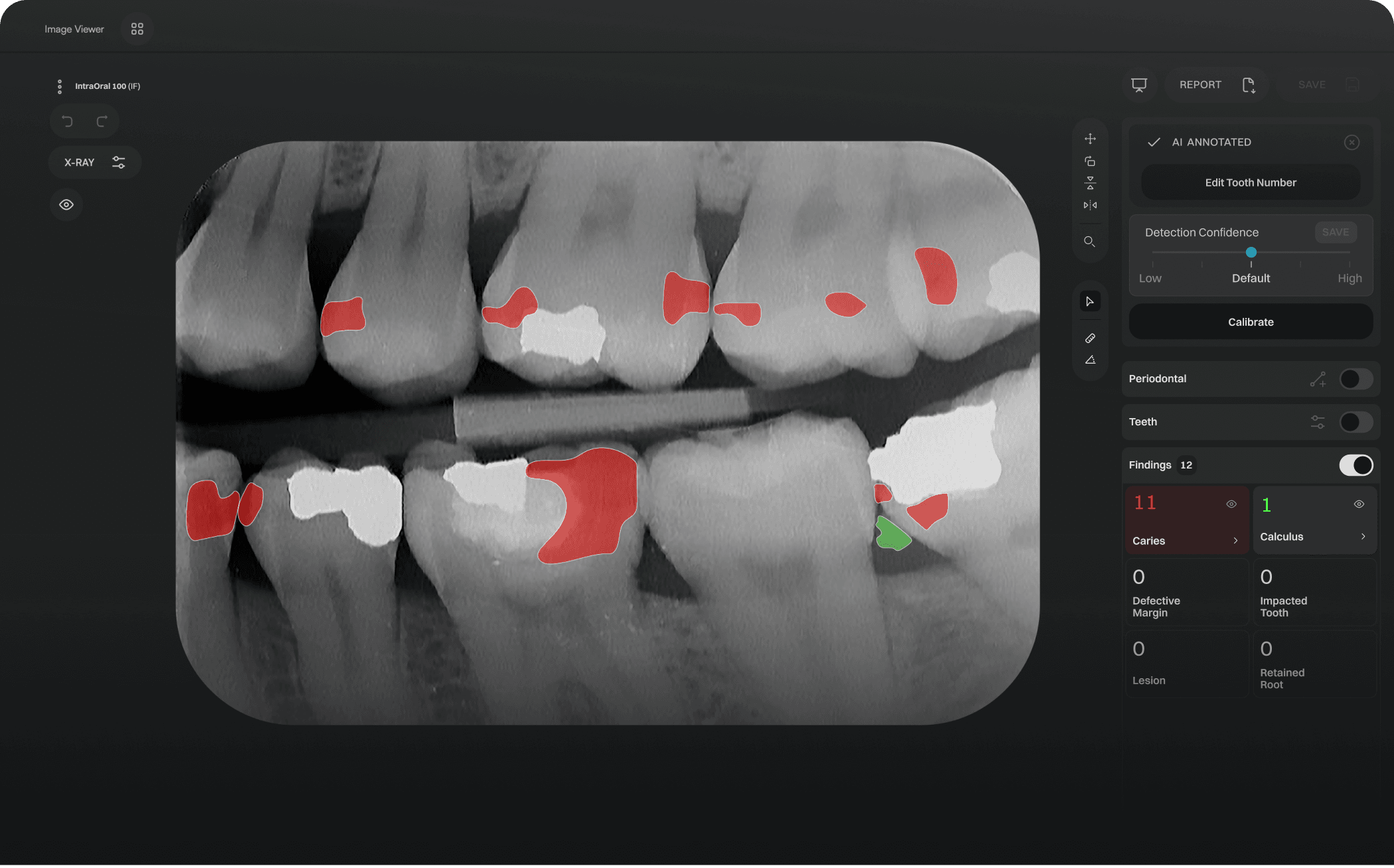 Viewer image