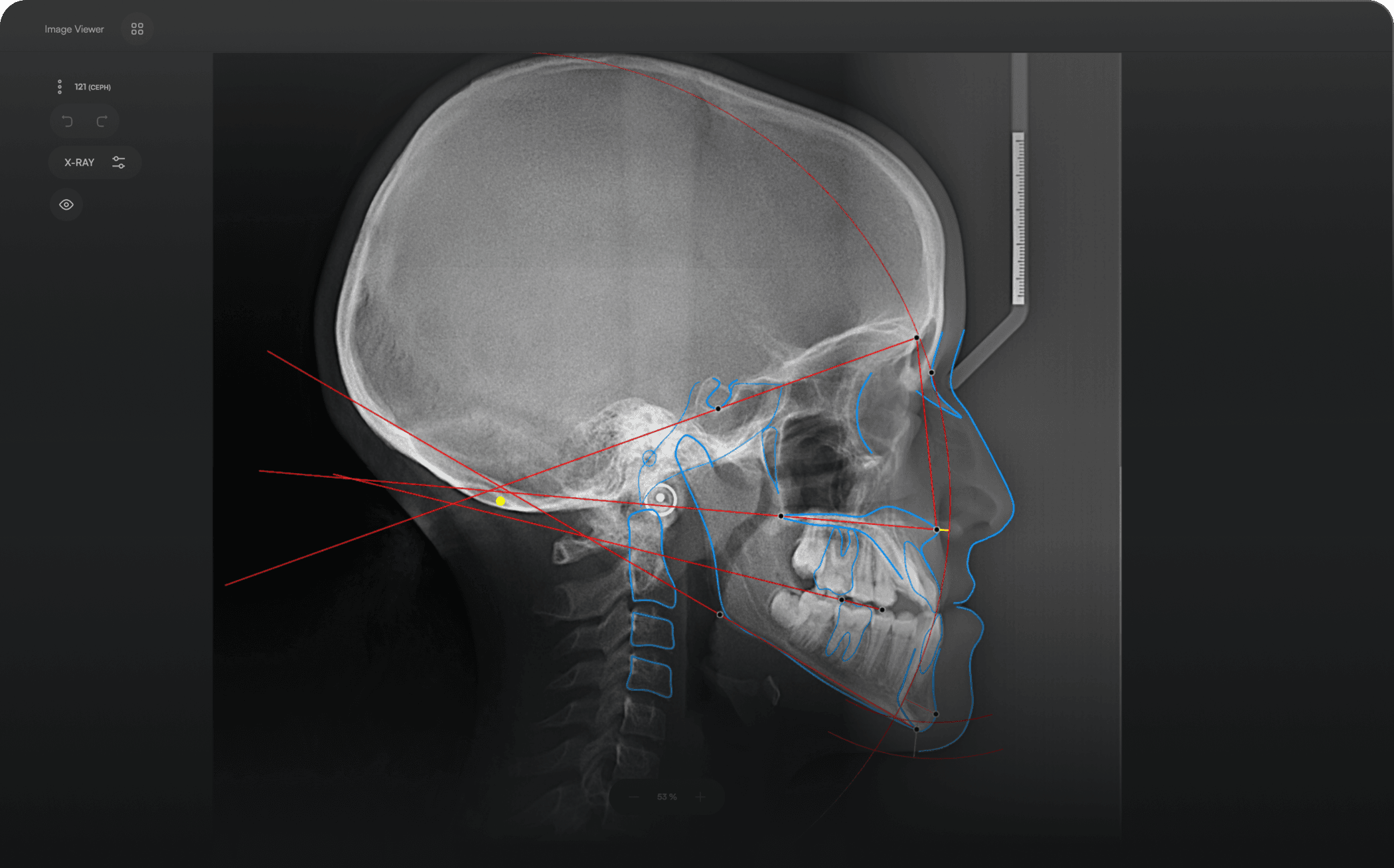 Viewer image